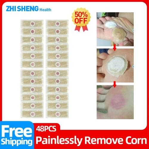 Foot Corn Removal Plaster Wart Remover Patch Feet Corns Papillomas And Warts MoleTreatment Health Care Tool 12/24/36/48 pcs