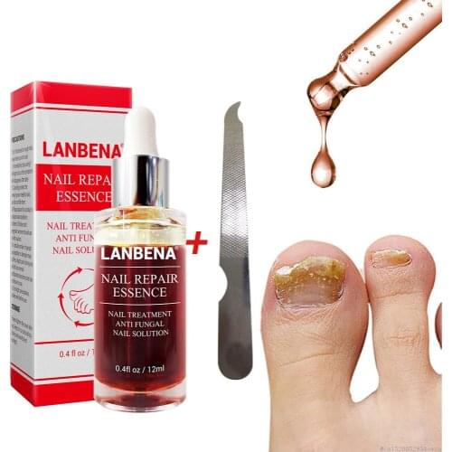 3pcs Nail Repair Liquid Treatment with File Nail Anti Remove Nail Onychomycosis Fungus Toe Nourishing Brighten Nail TSLM1