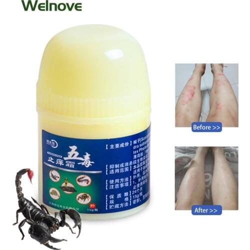 15g Scorpion Venom Cream Skin Itching Infect Cream Psoriasis Dermatitis Treatment Ointment Herbal Antifungal Eczema Dermatitis