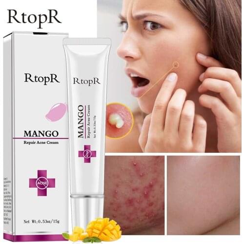 2pcs Acne Treatment Face Cream Effective Acne Removal Cream Blackhead Repair Anti-acne Shrink Pores Scar Acne Cream Facial Care