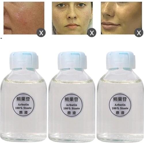 5pcs Arbutin Skin Brightening Essence Liquid Whitening Lightening Serum Kojic Acid Serum Removing Chloasma Bleaching Cream 30ml
