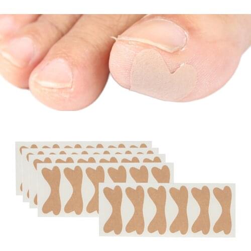 Glue Free Ingrown Toenail Stickers Professional Painless for Women Foot Care