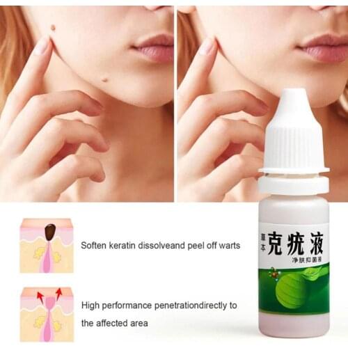 10ML Skin Tag Remover Cream Against Mole Genital Wart Fast Remover Removal Papillomas Rapidly Removes Mole Anti Foot Corn N1