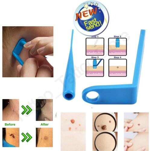 Medical Skin Tag Kill Skin Mole Wart Remover Micro Band Skin Tag Removal Kit With Cleansing Swabs Adult Mole Wart Face Care Tool