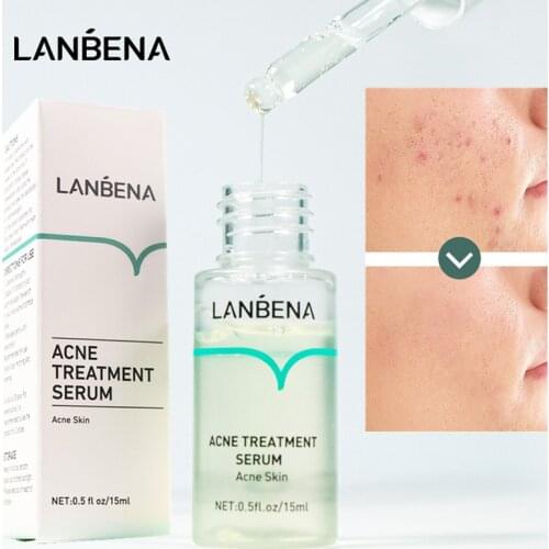 LANBENA Acne Treatment Serum 15ML Anti Acne Facial Essence Scar Removal Whitening Deep Repair Pimple Plant Extracts Skin Care