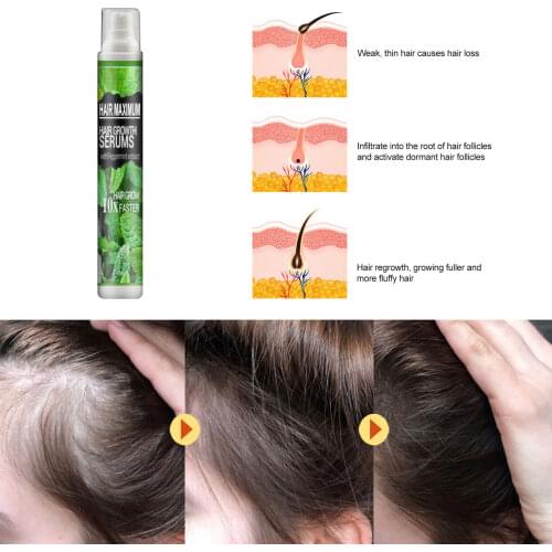 Ginger Hair Growth Serum Hair Loss Spray 7 Days Effective Germinal Hair Growth Essential Oil Men Women Hair Care 10ml