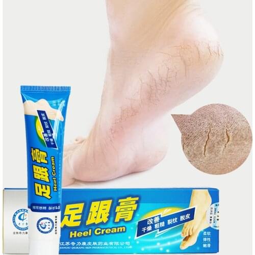 Cracked heel repair cream to remove dead skin Chinese medicine 33g oil control anti-chapped foot cream hand and foot care