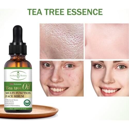 100% Natural Tea Tree Essential Oil Anti-wrinkle Extract Acne Pores Removal Scars Marks Treatment Massage Oil for Any Skin Care