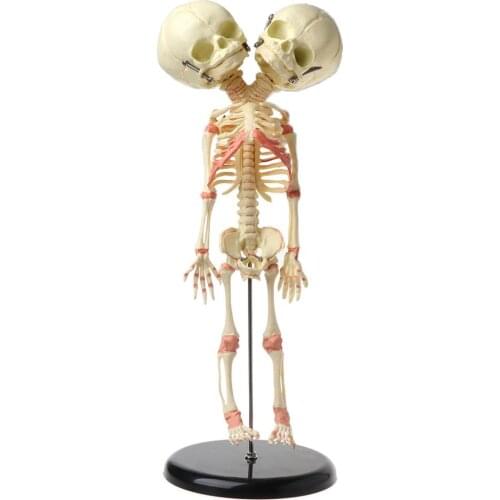 37cm Human Double Head Baby Skull Skeleton Anatomy Brain Display Study Teaching Anatomical Model