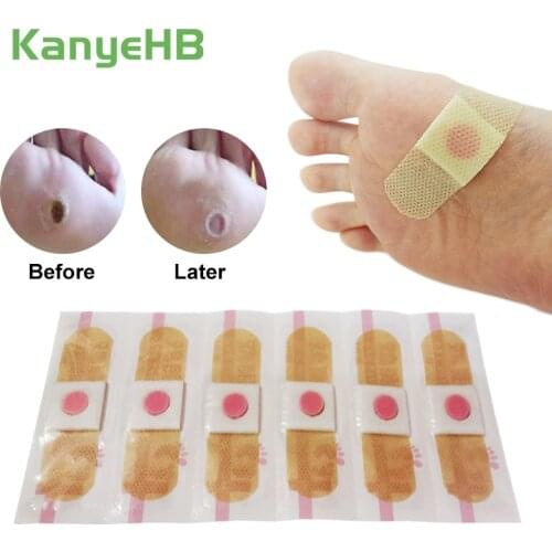 12pcs Foot Care Medical Plaster Foot Corn Removal Calluses Plantar Warts Thorn Plaster Foot Care Tools Pain Relief Pads Patch