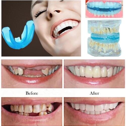 3 Stages Dental Orthodontic TPE Braces Appliance Trainer Alignment Dental Braces Mouthpieces for Adults Tooth Care Tool