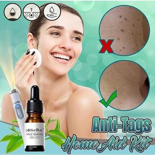 Skin Tag Remover Against Mole & Genital Wart Rapidly removes Anti Foot Corn Removal Warts Papillomas fast Removal moles