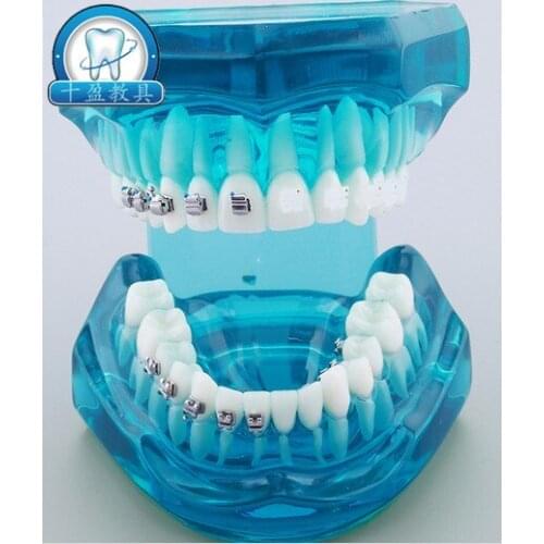 Dental Orthodontic teaching Model Ceramic Ceramic Metal Tongue Self-locking 4 Bracket Contrast demonstration