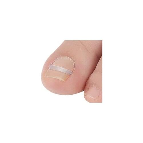 2 box Toe Nail Ingrown Correction Sticker Paronychia Elastic Toenail Patch Foot Care Corrector Pedicure Straightening Clip