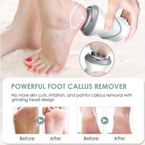 LANBENA Foot Care Tools