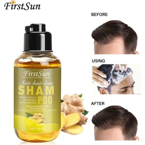 2Pcs 100ML Herbal Ginger Shampoo for Hair Growth Treatment for Hair Loss Thicker Fuller Hair Anti Dandruff Women & Men Hair Care