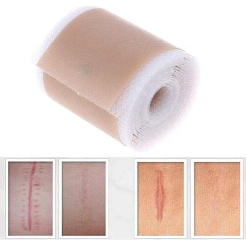 Efficient Surgery Scar Removal Silicone Gel Sheet Therapy Patch for Acne Trauma Burn Scar Skin Repair Scar Treatment 4x150cm