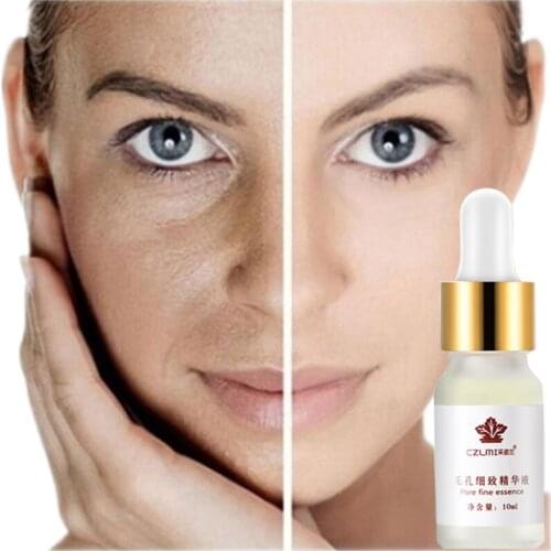 10ml Hyaluronic Acid Pores Shrinking Serum Anti Acne Moisturizing Whitening Lighten Essence Anti-Aging Facial Repair Skin Care