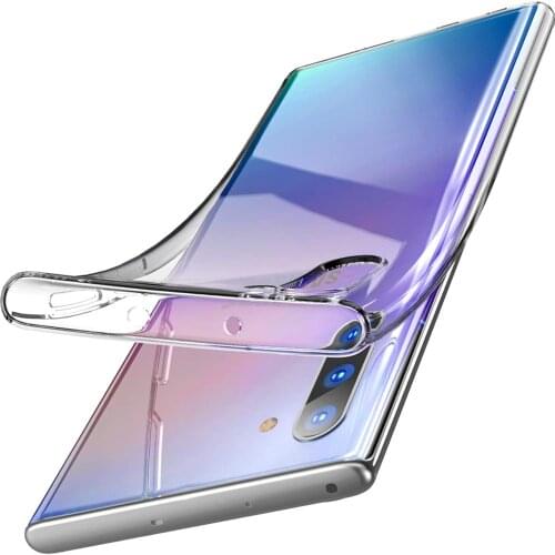 SuaGet Xiaomi Mi 6 Phone Cases