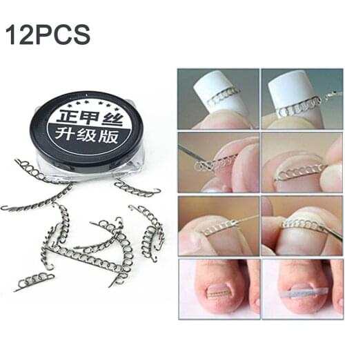 12Pcs Ingrown Toe Nail Correction Wire Pedicure Toenail Orthotic Pedicure Paronychia Recover Nail Toenails Corrector For Toes