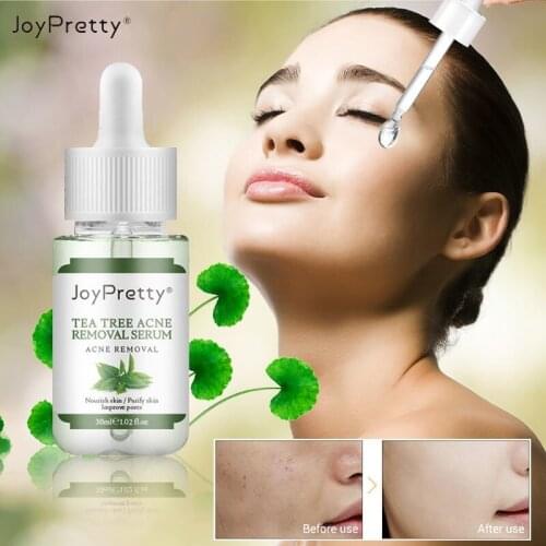 Tea Tree Acne Removal Serum Pimple Acne Treatment Essence Shrink Pores Smooth Skin Oil Control Moisturizing Facial Care 30ml