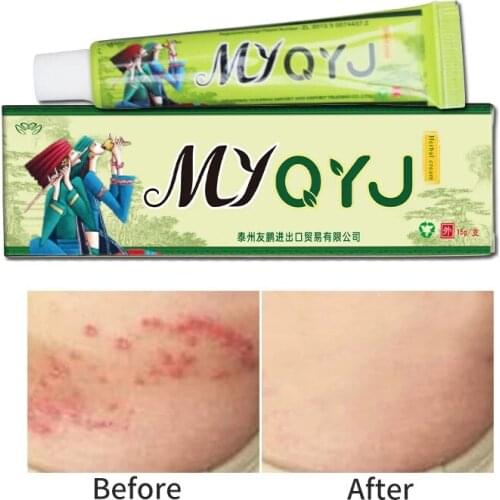 10pcs MYQYJ Herbal Psoriasis Skin Care Creams Exclusively To Skin Problems Prutitus Dermatitis Eczematoid Eczema Cream15g