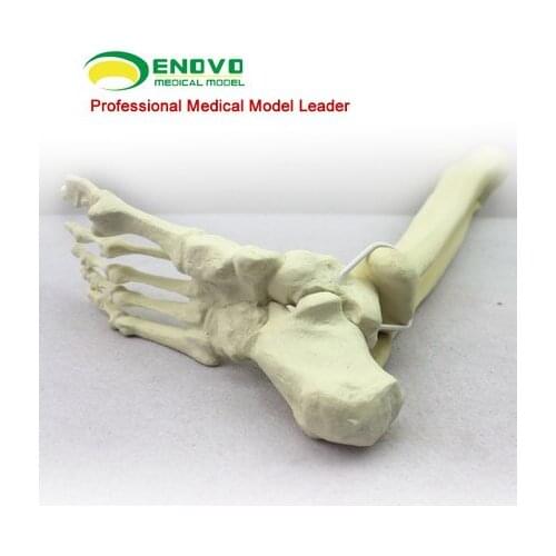 Orthopedic surgery simulation Sawbone artificial bone artificial bone model ankle model connection tibia fibula