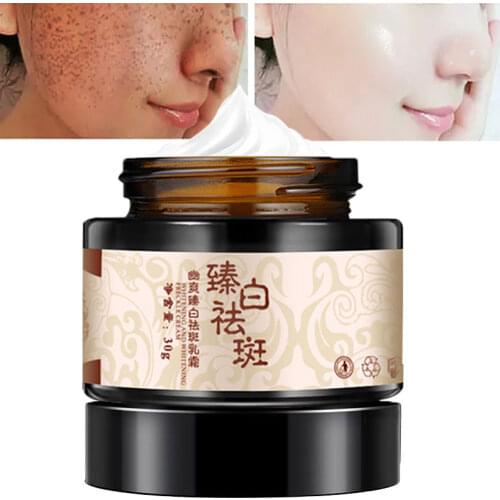 Anti-freckle Cream Whitening Fades Stains Brighten Complexion Hydrate Moisturizing Repair Arbutin Hyaluronic Acid Skin Care 30g