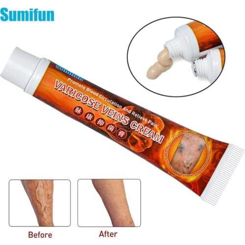 1pcs Sumifun Varicosity Angiitis Remedy Ointment Varicose Veins Treatment Cream Relief Veins Pain Phlebitis Spider legs P1109