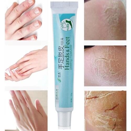 20g moisturizing hand foot and body cream hydrates dry skin rigorously hands for feet peeling