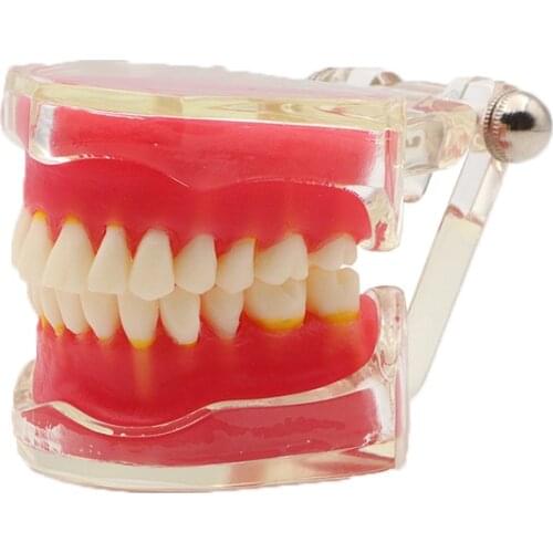 1 Piece Full Mouth Removable Model with 28pcs Teeth and Soft Gum Dental Teeth Model Without Screw for Dental Teaching Training