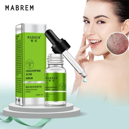 Oligopeptide Acne Balance Water And Oil Essence Acne Treatment Shrink Pores Whitening Anti-Wrinkle Moisturizing Essence 10ml