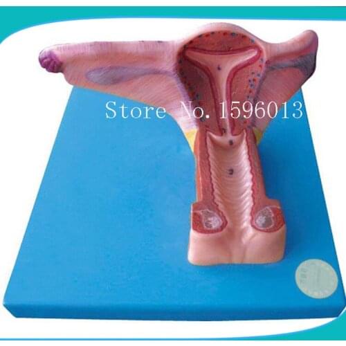 Female Inner Genital Organ Model