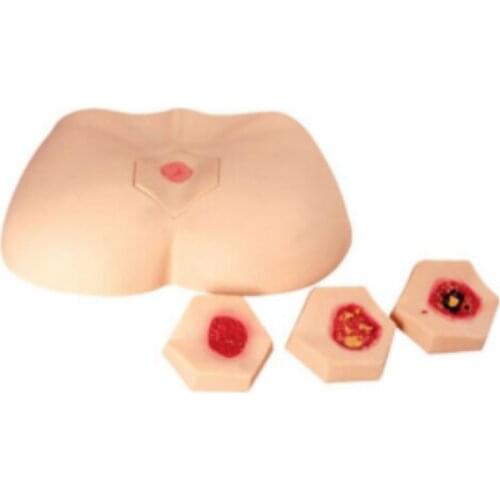 BIX-H10B Medical Training Model New Type Stage Bedsore Decubitus Ulcer Care Simulator WBW047