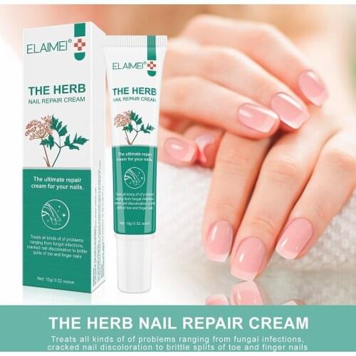 Herbal Fungal Nail Repair Cream 15g Anti Fungus Nails Treatment Anti-Fungal Onychomycosis Paronychia Nail Infection Toenail Care