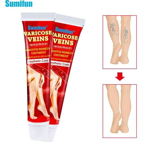 Sumifun 1/2pcs New Varicose Veins Treatment Cream 100% Original Vasculitis Phlebitis Spider Pain Relief Ointment Medical Plaster