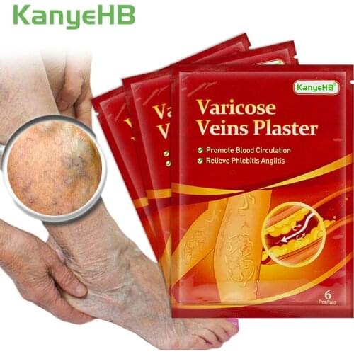 6pcs/bag Chinese Varicose Veins Plaster Vasculitis Phlebitis Spider Leg Medical Patch Angiitis Removal Patch