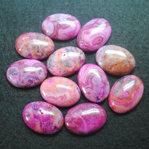10pcs nature gem stone cabochons oval shape 18x25mm malachite stone beads pink colors diy beads accessories