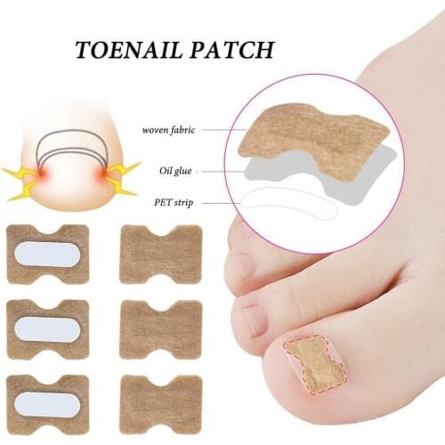 10pcs Ingrown NailsToenail Correction Ingrown Toe Nail Treatment Elastic Straightening Patch Sticker Clip Brace Pedicure Tool