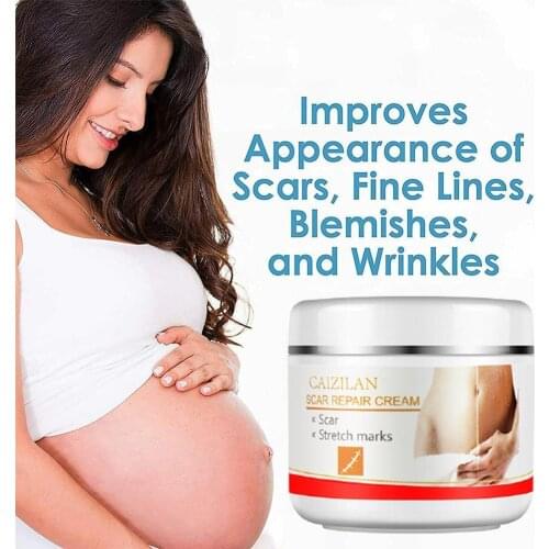 Peach Kernel Stretch Marks Remover Cream Eliminate Pregnancy Scars Maternity Repair Anti Winkles Skin Firming Skins Treatment