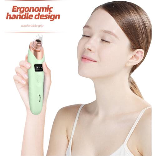 CkeyiN Blackhead Remover Vacuum Microdermabrasion Pore Acne Pimple Removal Facial Whitehead Black Head Suction Rechargeable 50