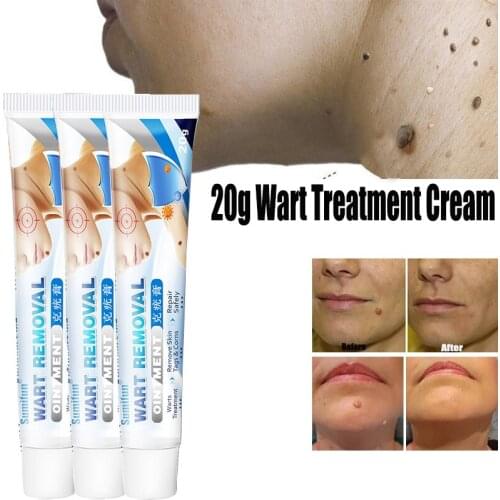 20g Wart Treatment Cream Natural Herbal Wart Antibacterial Ointment Skin Tags Remover Face Foot Extract Corn Viral Cream