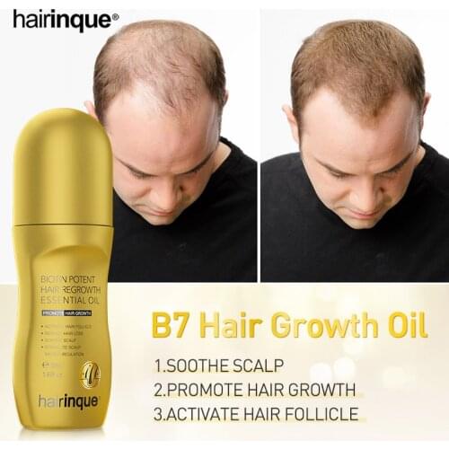 50ml Vitamin B7 Hair Growth Oil Anti Hair Loss Fall Treatment Serum Fast Grow Hair Thickener Regrowth Products for Men Women