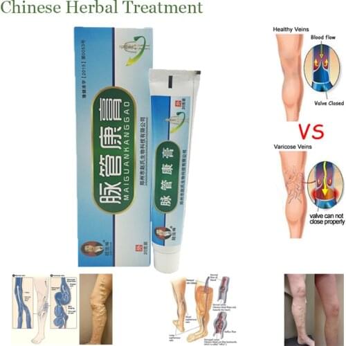 1boxes Chinese natural herbal medicine for treating varicose vascular inflammation massage cream cure varicose vein ointment
