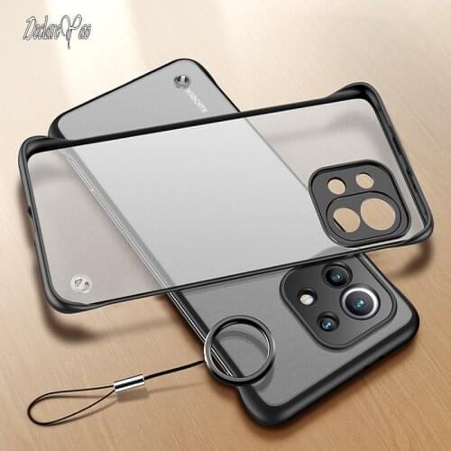 Mi 11 Cover XUANYAO Case For Xiaomi Mi 11 10 9 8 Pro Case Slim Matte Cover For Xiaomi Mi 10 Ultra 9T 10T Lite Case Frosted Hard