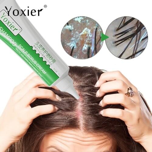 Yoxier Hair Loss Remedies