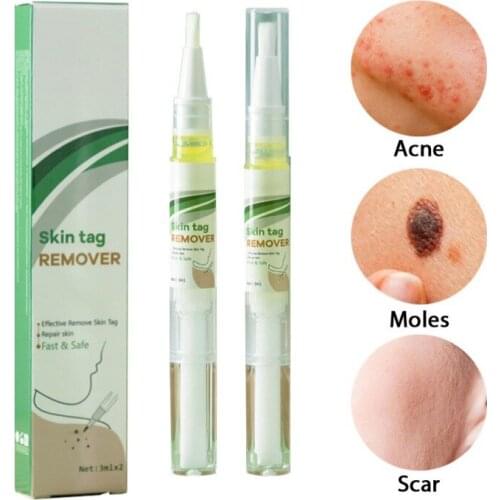 Remover Wart Skin Tag Natural Bacteriostatic Liquid Removal Mole&Papillomas Foot Corn Repair Tool Anti Wart Bacteriostatic