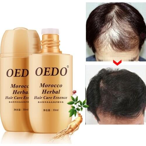 Effective Fast Hair Growth Essence Oils Advanced Thinning Hair & Hair Loss Supplement Beauty Support Anti-off Hair Care Solution