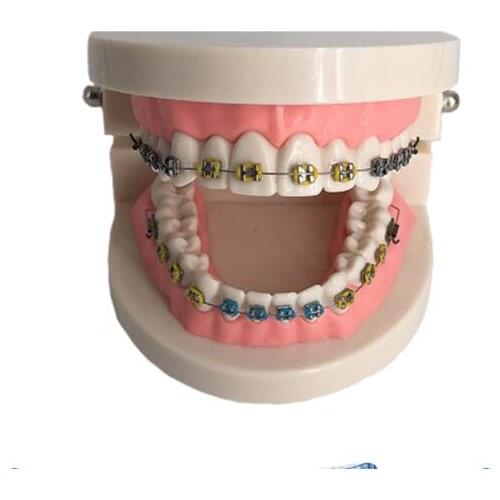 Tooth model oral model orthodontic dental tooth model