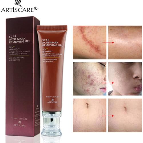ARTISCARE Scar Acne Mark Removing Gel TCM Blackhead Treatment Whitening Skin Care Makes Repair Skin Soft Smooth Face Cream
